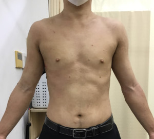 2年後