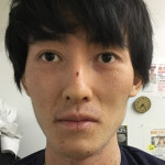 Before