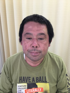 初診時