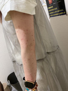 6か月後の写真
