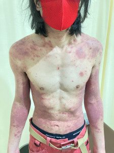 初回の写真