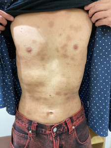 6ヶ月後の写真