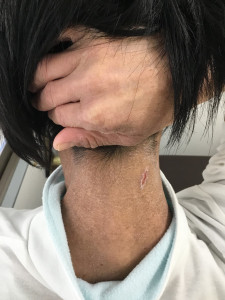 初診時
