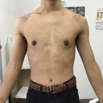 1年半後の写真