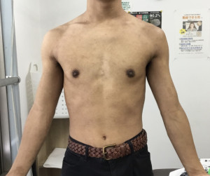 1年半後の写真