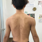 1年半後の写真
