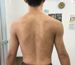 1年半後の写真