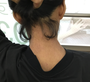 3年後