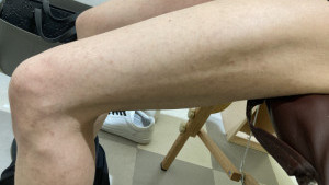 4ヶ月後の写真