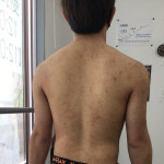 初回の写真
