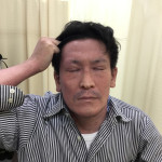 初診時