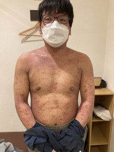 初回の写真