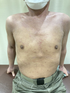 3ヶ月後の写真