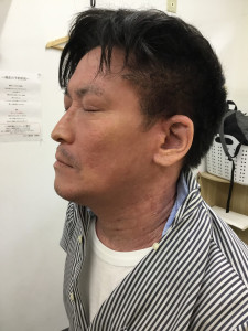 初診時
