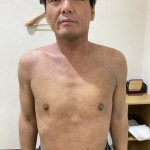 4か月後の写真