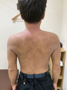 4ヶ月後の写真