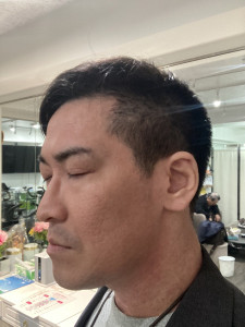 1年後